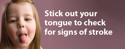 Stroke Symptoms